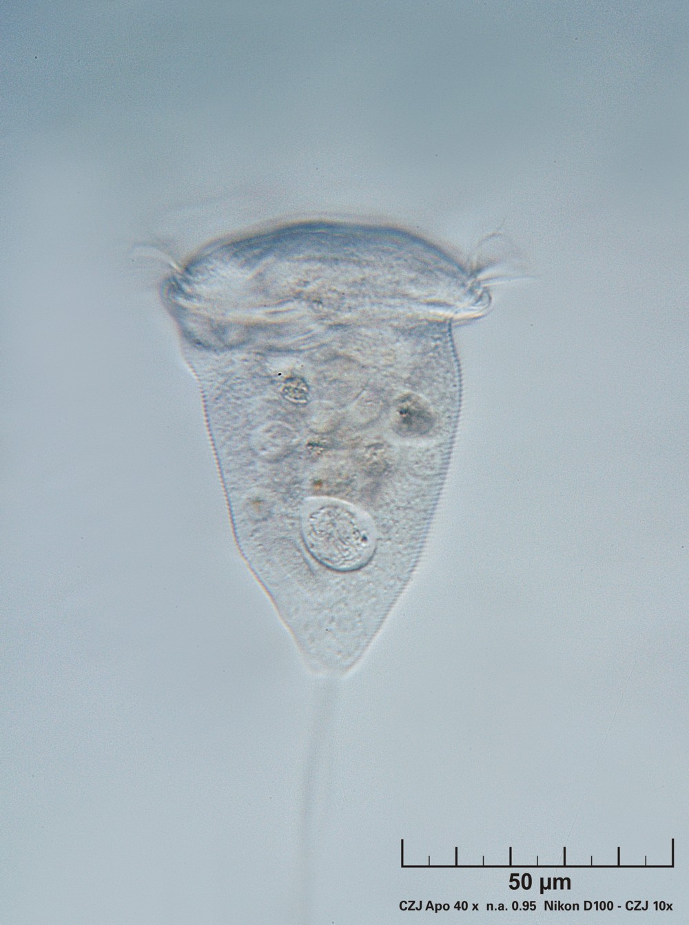 Vorticella